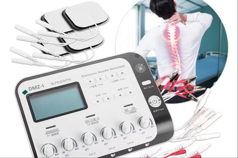 Elektroakupunktur adalah teknik yang menggabungkan akupunktur tradisional dengan stimulasi listrik. Dalam prosedur ini, jarum akupunktur yang telah dimasukkan ke titik-titik akupunktur pada tubuh dihubungkan dengan perangkat elektro yang menghasilkan arus listrik ringan. 